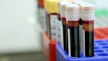 Stock image of blood vials